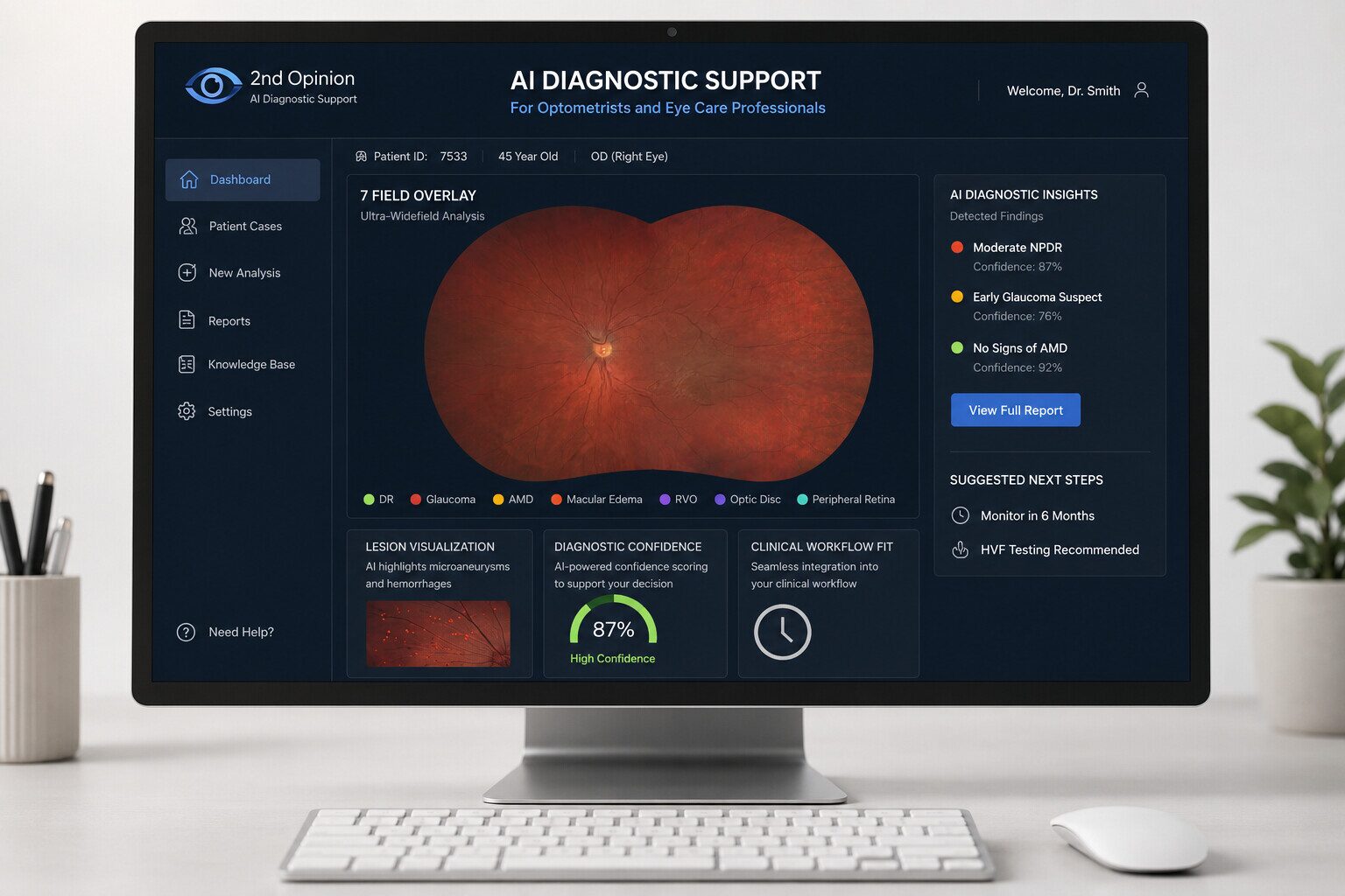 2nd Opinion AI Diagnostic Support — ultra-widefield retinal scan with a 7-field overlay